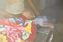 Thiếu niên thoát chết hi hữu khi bị sét đánh giữa đầu