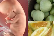 Loại trái cây giúp ngăn ngừa bệnh sỏi thận cho mẹ bầu