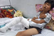 Xót xa hoàn cảnh éo le của cậu bé bị hổ cào nát chân