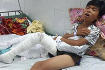 Xót xa hoàn cảnh éo le của cậu bé bị hổ cào nát chân