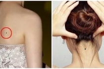 3 nốt ruồi cản trở tài lộc, 4 nốt ruồi phú quý đừng xóa đi