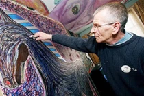 Những người chấn thương não trở thành thiên tài thế giới