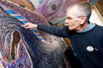 Những người chấn thương não trở thành thiên tài thế giới