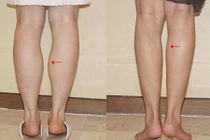 4 nét tướng tuy xấu nhưng lại giúp tiền ập vào nhà