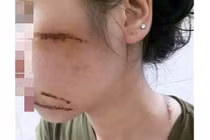 Hải Dương: Nữ nhân viên spa bị nhóm côn đồ chém trọng thương