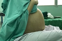 Cô gái 20 tuổi chết lặng khi biết "thủ phạm" khiến bụng to kỳ lạ