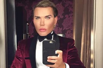 Búp bê sống suýt mất mũi vì ham hố phẫu thuật thẩm mỹ