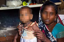 Nỗi đau chất chồng sau thảm án bé gái 11 tháng tuổi bị xâm hại