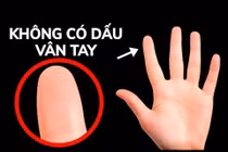 Video: Chuyện gì sẽ xảy ra nếu bạn mất dấu vân tay?