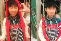 Câu chuyện đằng sau vụ cháu bé bị khóa dây xích quanh cổ