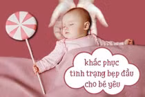 Những mẹo hay khắc phục tình trạng bẹp đầu, méo đầu cho bé yêu