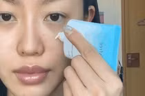 Lỗi khi thoa kem chống nắng khiến mụn nổi tùm lum