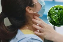 Người phụ nữ 30t có u tuyến giáp phồng to vì hay ăn món này