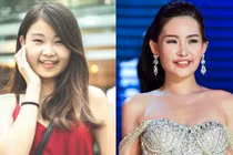 Lộ bằng chứng Lê Âu Ngân Anh mới đi làm răng để nâng cấp sắc đẹp