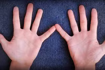 Xem số lượng hoa tay "đoán chuẩn ngay" tính cách, vận mệnh