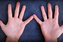 Xem số lượng hoa tay "đoán chuẩn ngay" tính cách, vận mệnh