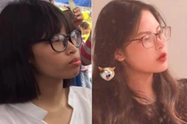 Bị chê miệng nạo được cả quả dừa, cô gái lột xác sau khi niềng răng