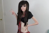 Video: Cô gái bị 'ném đá' vì giảm cân quá đà đến mức gầy trơ xương