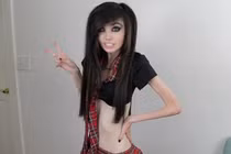 Video: Cô gái bị 'ném đá' vì giảm cân quá đà đến mức gầy trơ xương