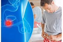 Đàn ông cao to bị ung thư tuyến tiền liệt dễ tử vong