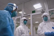 F0 bị mất vị giác lâu, làm sao để chữa?