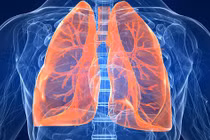 Chăm sóc phổi bằng những thực phẩm tự nhiên này 