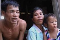 Chuyện tình “rổ rá” giữa cô nàng “chân voi” và anh chàng mù