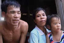 Chuyện tình “rổ rá” giữa cô nàng “chân voi” và anh chàng mù