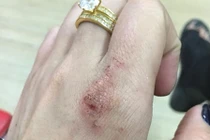 Vợ trẻ kể khổ khi bị nhân tình đánh ghen ngược ngày Valentine