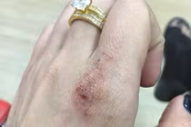 Vợ trẻ kể khổ khi bị nhân tình đánh ghen ngược ngày Valentine