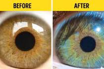 5 điều kỳ lạ có thể làm thay đổi màu mắt của bạn