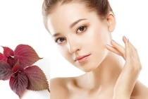 Cách trị nám cho da sáng bằng tía tô có thể thực hiện tại nhà