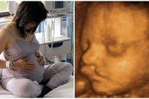 Con bị hở hàm ếch, mẹ chết lặng khi biết nguyên nhân do mình