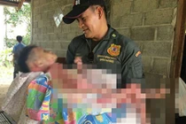 Bệnh lạ khiến thiếu nữ phải mắc màn khi đi chơi