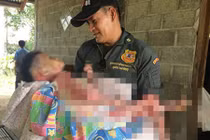 Bệnh lạ khiến thiếu nữ phải mắc màn khi đi chơi