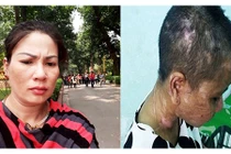 Cô gái bị chủ bạo hành, tra tấn như thời trung cổ nói gì?