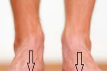 Nhìn tướng bàn chân biết số mệnh giàu sang hay nghèo hèn