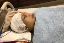 Hải Dương: Đang điều tra vụ PCT xã An Thượng bị côn đồ đánh nhập viện