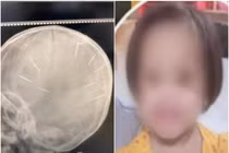 Vì sao gã “cha dượng” đóng đinh đầu bé 3 tuổi ở Hà Nội?
