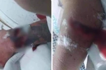 Lộ nguyên nhân nam thanh niên chém bố bạn gái ngày đầu về ra mắt?