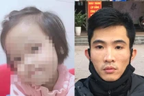 Toàn cảnh vụ bé gái 3 tuổi tử vong do bị đóng đinh vào đầu