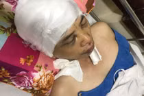 Phó Chủ tịch xã ở Hải Dương bị đánh: Lần đầu tiên nạn nhân lên tiếng