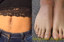 Dù là nam hay nữ, có 4 vị trí lông càng mọc nhiều càng phát tài