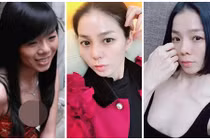 Nhan sắc Lệ Quyên thời chưa nâng mũi và sau 5 năm tháo sụn