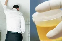 Thấy 4 thay đổi này khi đi tiểu, kiểm tra càng sớm càng tốt