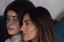 Video: Những cô gái bạch tạng, bị sắc tố da thành người mẫu 