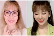 Bị liệt cơ mặt trái, Hari Won giờ thế nào?