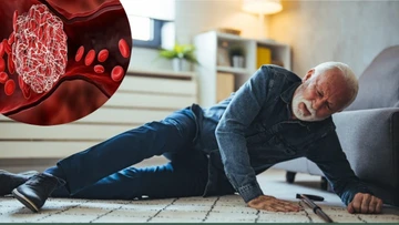 Nguy cơ chảy máu do chấn thương khi dùng thuốc chống huyết khối