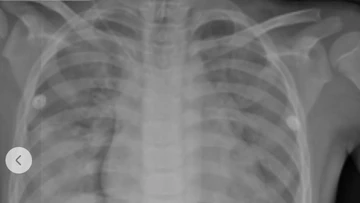 Đi bơi cùng cha, trẻ 10 tuổi ngạt nước nguy kịch