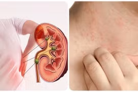 Khi chức năng thận suy giảm, có thể xuất hiện tình trạng da khô và ngứa. Ảnh: Internet.